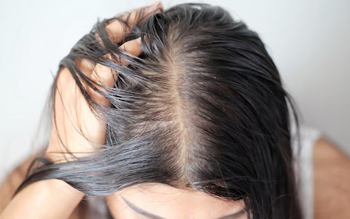 مراقبت از موهای چرب و نازک