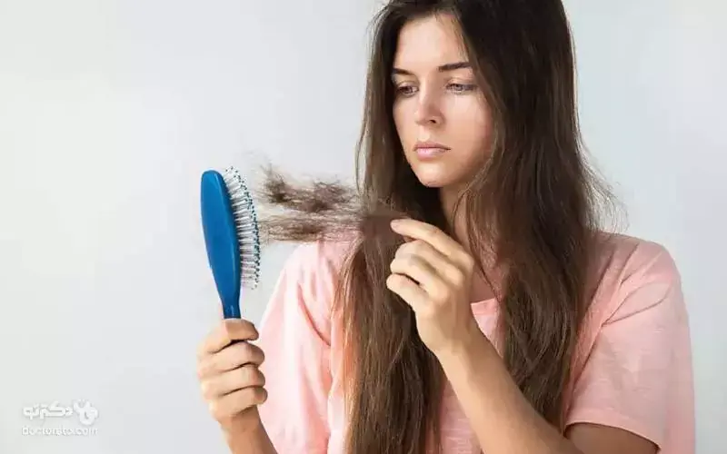 علت ریزش مو شدید در نوجوانی
