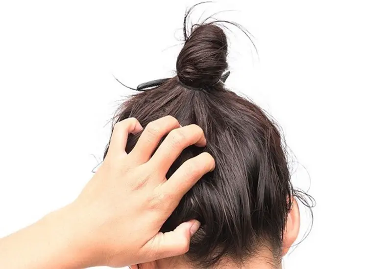 علت ریزش مو شدید بعد از کراتینه