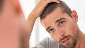 جلوگیری از ریزش مو در دوره استروئیدی