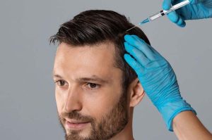 جلوگیری از ریزش مو در دوره استروئیدی